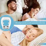 Load image into Gallery viewer, Anti Snoring Nose Clip Device for Men Women Nasal Strips Stops Snoring Stopper Anti-snoring Device  (Nose Clip)
